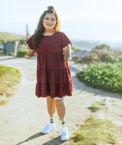 Andrea, Beautifully Flawed Attendee, standing on her prosthetic legs